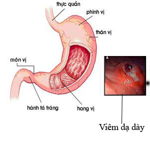 viem-da-day-man-tinhh-nguyen-nhan-va-cach-dieu-tri1