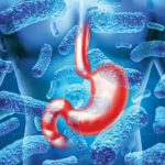 Bị ung thư dạ dày có thể sống được bao lâu?