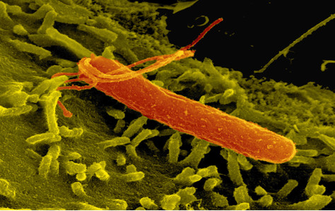 Kiểm soát chặt chẽ nhiễm khuẩn Helicobacter pylori (Hp) 1