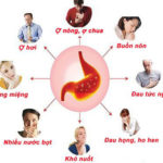 Các phương pháp chuẩn đoán bệnh dạ dày không cần nội soi Các phương pháp chuẩn đoán bệnh dạ dày không cần nội soi
