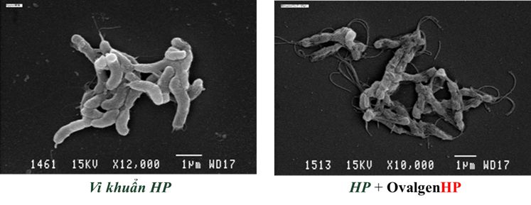 Hình ảnh vi khuẩn HP trên kính hiển vi