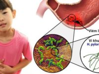 Trẻ đau bụng âm ỉ, viêm dạ dày do lây nhiễm vi khuẩn HP từ người lớn