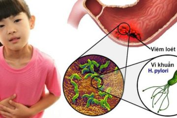 Trẻ đau bụng âm ỉ, viêm dạ dày do lây nhiễm vi khuẩn HP từ người lớn